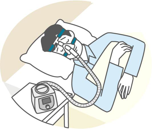 CPAP療法について